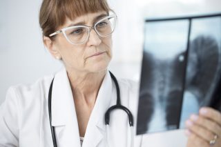 lung specialists in Singapore