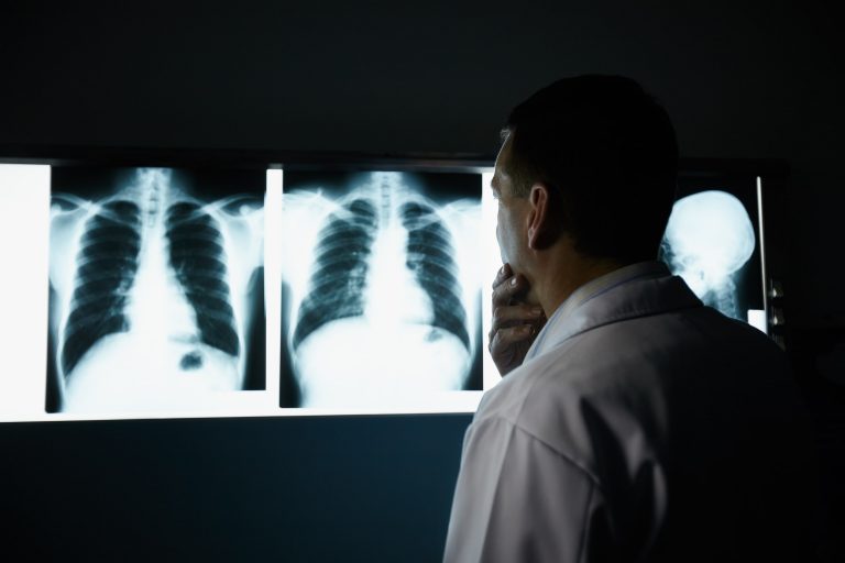 lung specialists in Singapore