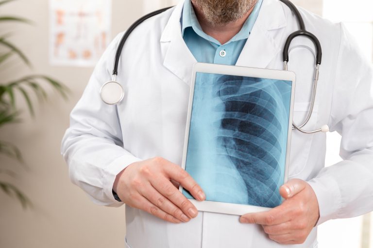 lung cancer specialists in Singapore