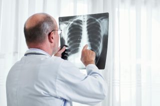 lung cancer specialists in Singapore