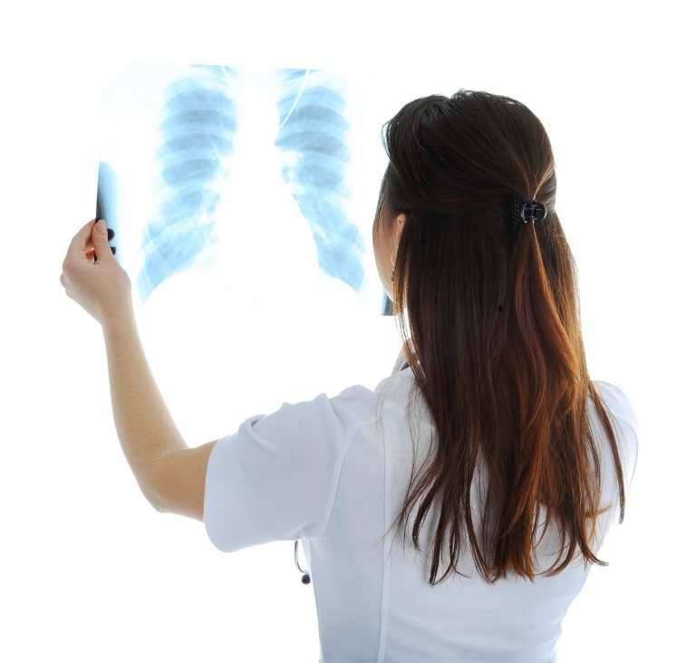 lung specialists in Singapore