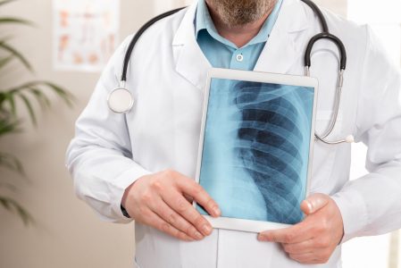 Chronic Obstructive Pulmonary Disease: Causes, Symptoms, and Non-Emergency Care
